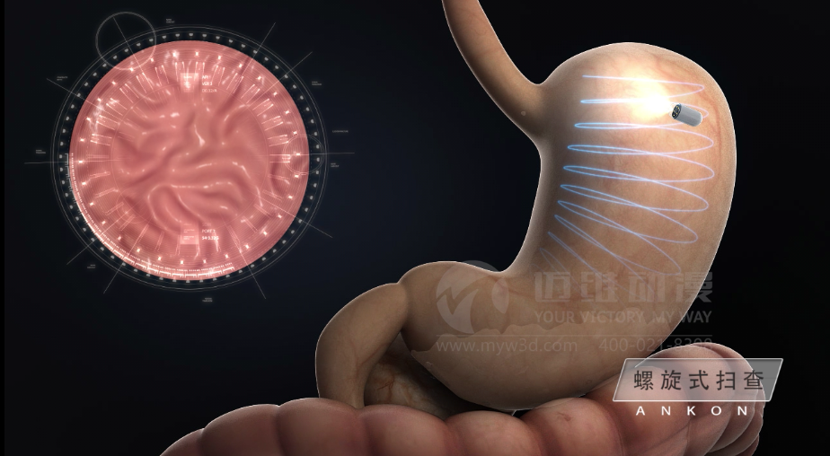 醫(yī)學醫(yī)療三維動畫 醫(yī)學醫(yī)療三維動畫