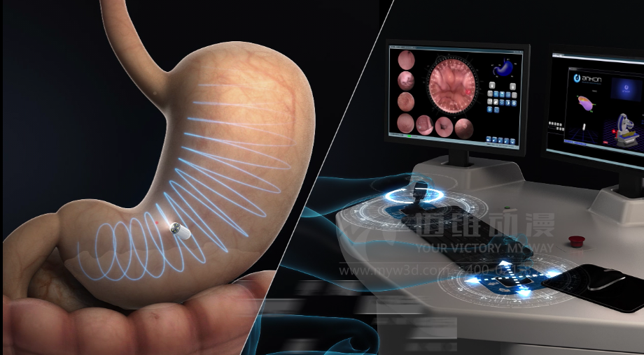 醫(yī)學醫(yī)療三維動畫 醫(yī)學醫(yī)療三維動畫