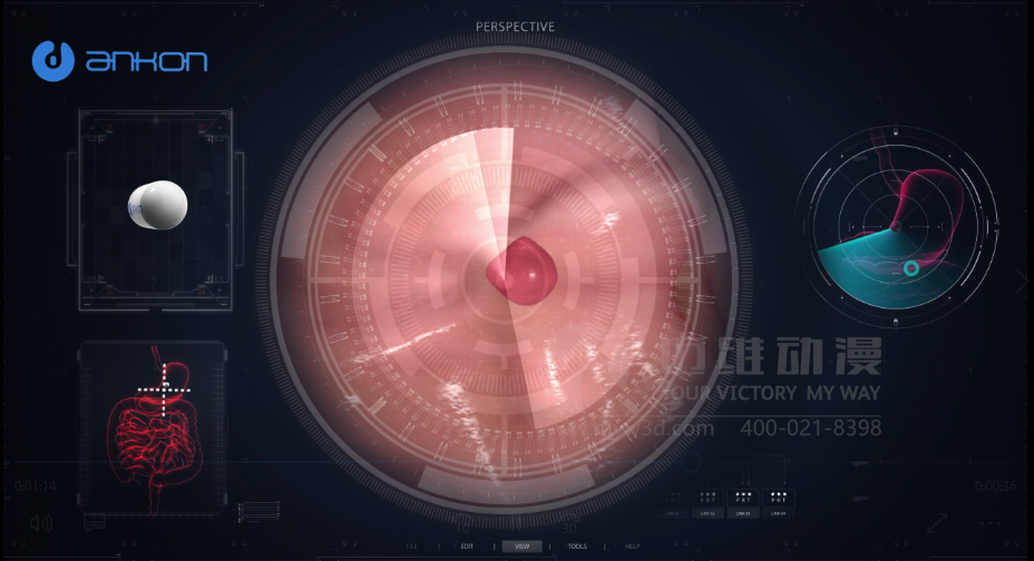 醫(yī)學醫(yī)療三維動畫 醫(yī)學醫(yī)療三維動畫