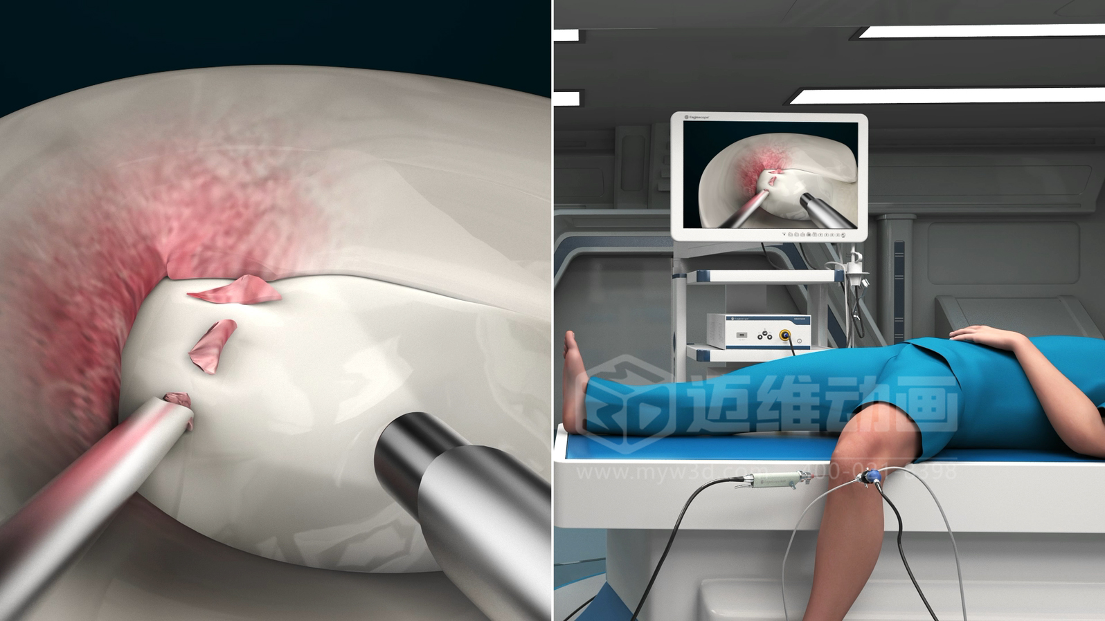 三維動(dòng)畫(huà)制作在展現(xiàn)醫(yī)療器械方面能給企業(yè)帶來(lái)諸多優(yōu)勢(shì)，這5點(diǎn)不容忽視！(圖3)