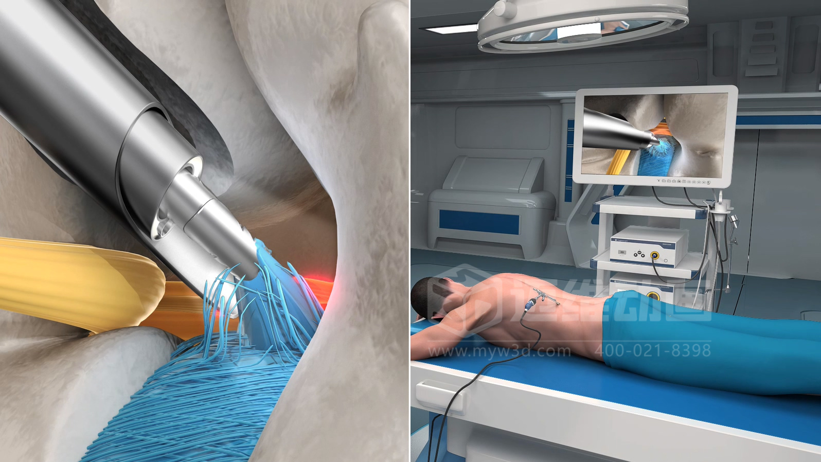 企業(yè)制作工程施工|自動(dòng)化生產(chǎn)線|產(chǎn)品演示|醫(yī)學(xué)行業(yè)三維動(dòng)畫要準(zhǔn)備哪些資料，以便有效地提供給三維動(dòng)畫制作公司呢？(圖7)