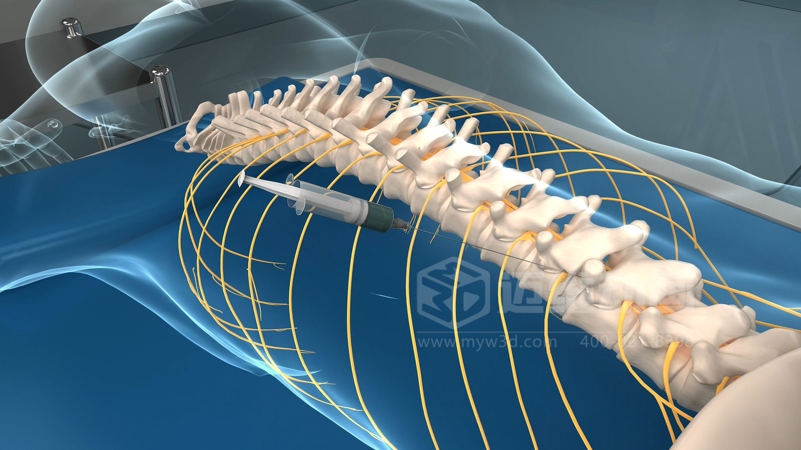從實(shí)驗(yàn)室到手術(shù)室：邁維動(dòng)漫用三維動(dòng)畫(huà)，讓精密科技“看得見(jiàn)，懂得到”訂單轉(zhuǎn)化率提高 50%(圖6)