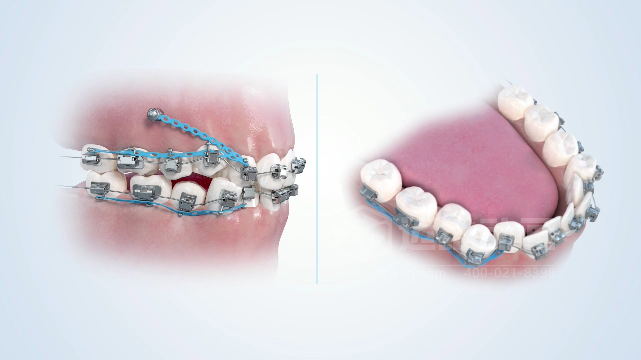 從實(shí)驗(yàn)室到手術(shù)室：邁維動(dòng)漫用三維動(dòng)畫(huà)，讓精密科技“看得見(jiàn)，懂得到”訂單轉(zhuǎn)化率提高 50%(圖10)