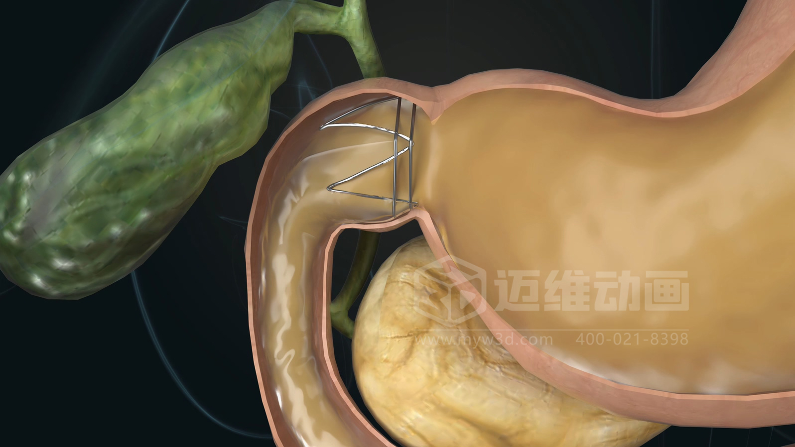 從實(shí)驗(yàn)室到手術(shù)室：邁維動(dòng)漫用三維動(dòng)畫(huà)，讓精密科技“看得見(jiàn)，懂得到”訂單轉(zhuǎn)化率提高 50%(圖11)