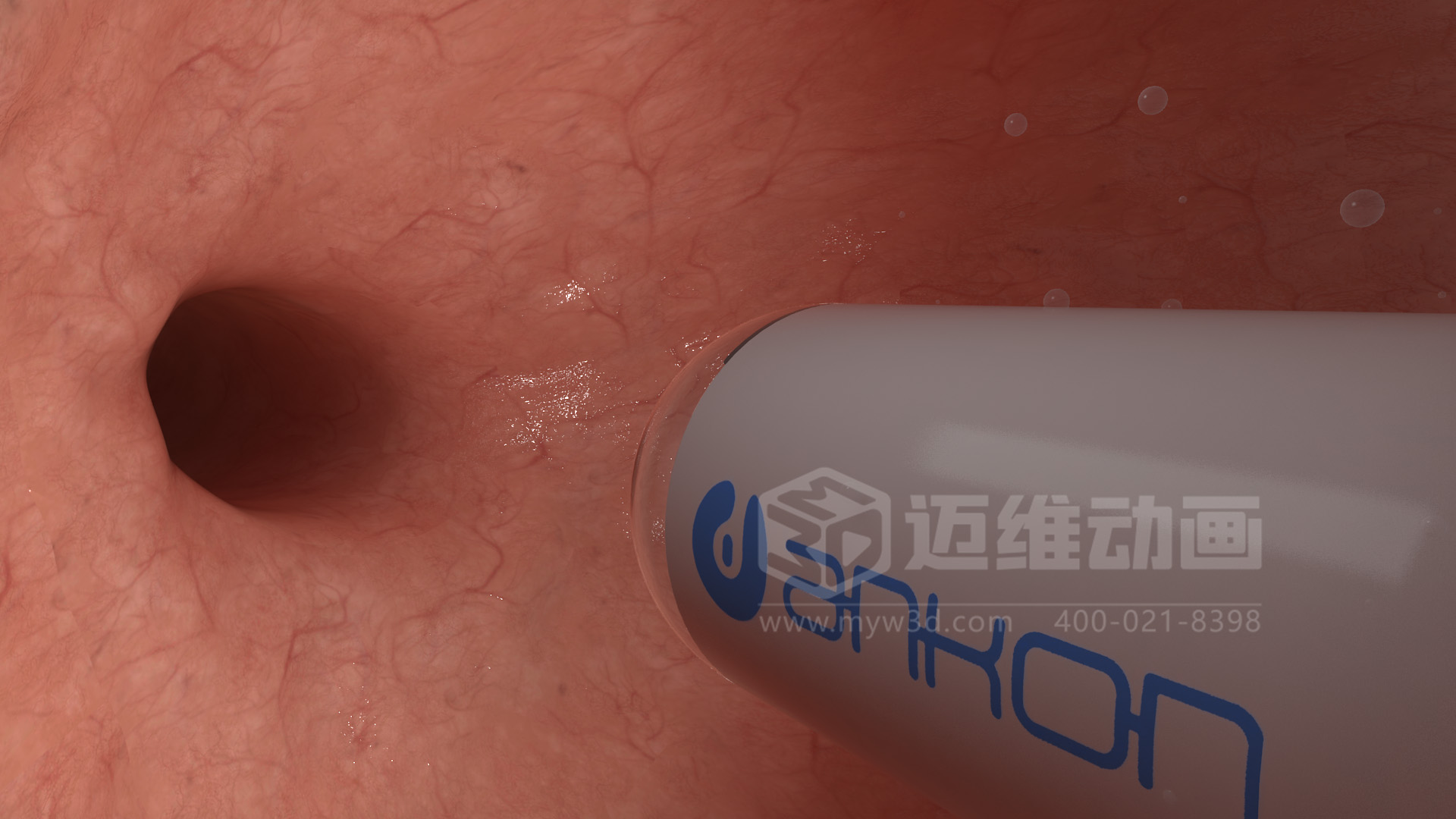 醫(yī)學(xué)檢測設(shè)備如何突破消化道檢查壁壘？三維動畫還原核心技術(shù)與臨床價值(圖4)